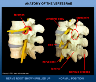 Common Spinal Conditions - ShimSpine